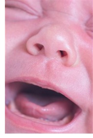 What Is Colic?